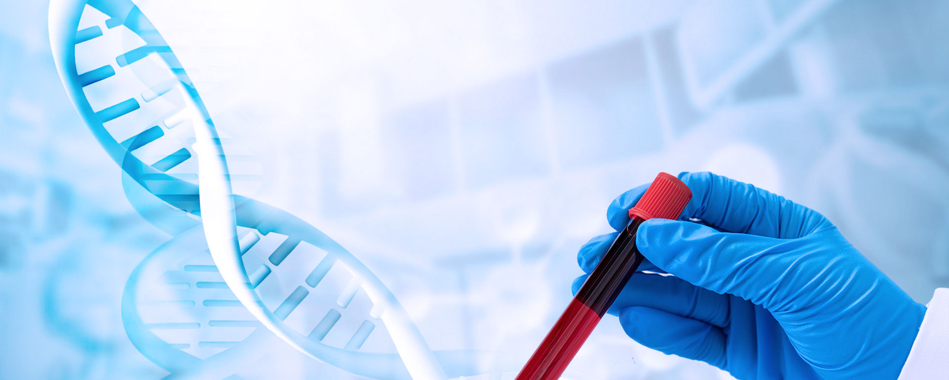 Types Of Chromogen Reagent/Trinder's Reagent